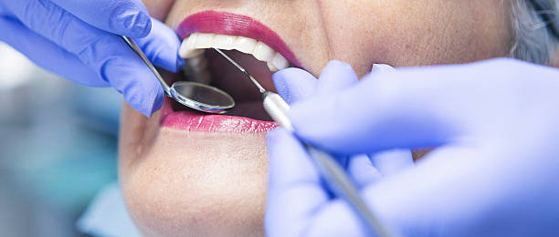 Best Emergency Treatment for Dental Infections or Abscesses in Cleveland, TN